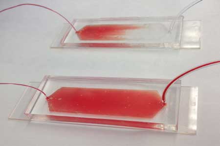 The Graphene-based device captures cancer cells from a blood sample